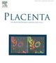 IFPA(international fedration of placecta association)